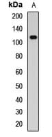 PDE3B Antibody