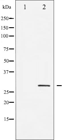 SNAI1 / SNAIL-1 Antibody (phospho-Ser246)
