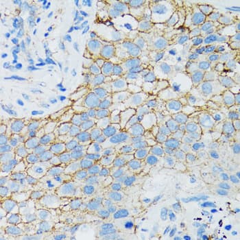 CTNNA1 / Catenin Alpha-1 Antibody