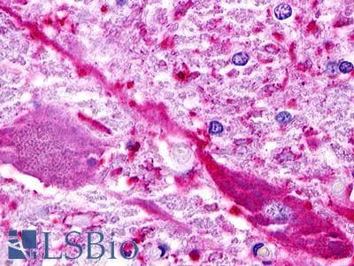 PathPlus™ RXFP1/ LGR7 Antibody (C-Terminus)