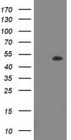 LPL / Lipoprotein Lipase Antibody (clone OTI4G2)