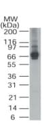 IHC-plus™ ALAS1 Antibody (aa480-530)