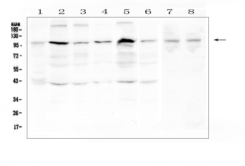 RPS6KA2 / RSK3 Antibody