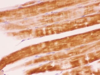 Polyclonal Rabbit anti-Human PTPN11 / SHP-2 / NS1 Antibody (IHC, WB)