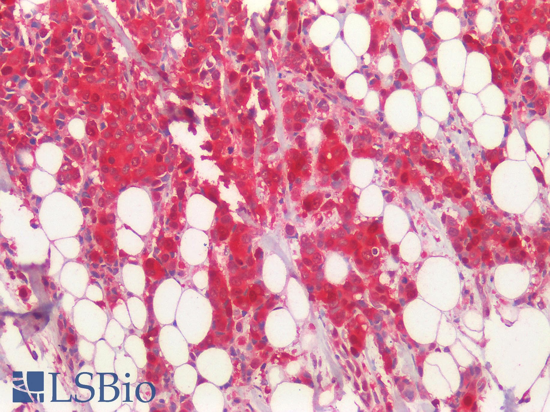 PathPlus™ Polyclonal Rabbit anti-Human APOBEC3B Antibody (IHC, IF, WB)