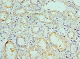 Polyclonal Rabbit anti-Human NIP3 / BNIP3 Antibody (aa1-164, IHC)