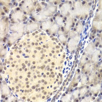 PAWR / PAR4 Antibody