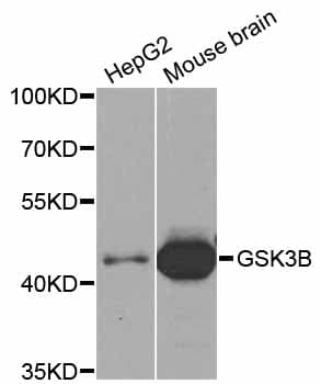 Polyclonal Rabbit anti-Human GSK3B / GSK3 Beta Antibody (WB)
