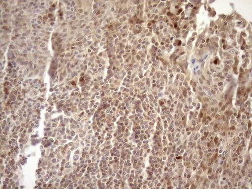 MGMT Antibody (clone OTI10H9)