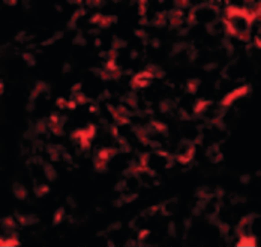 NANOS2 / NOS2 Antibody