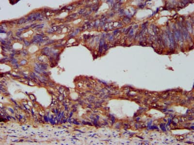 Polyclonal Rabbit anti-Human PCSK7 / PC7 Antibody (IHC)
