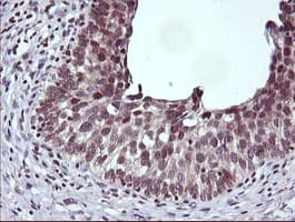 CTAG1B / NY-ESO-1 Antibody (clone OTI5A5)