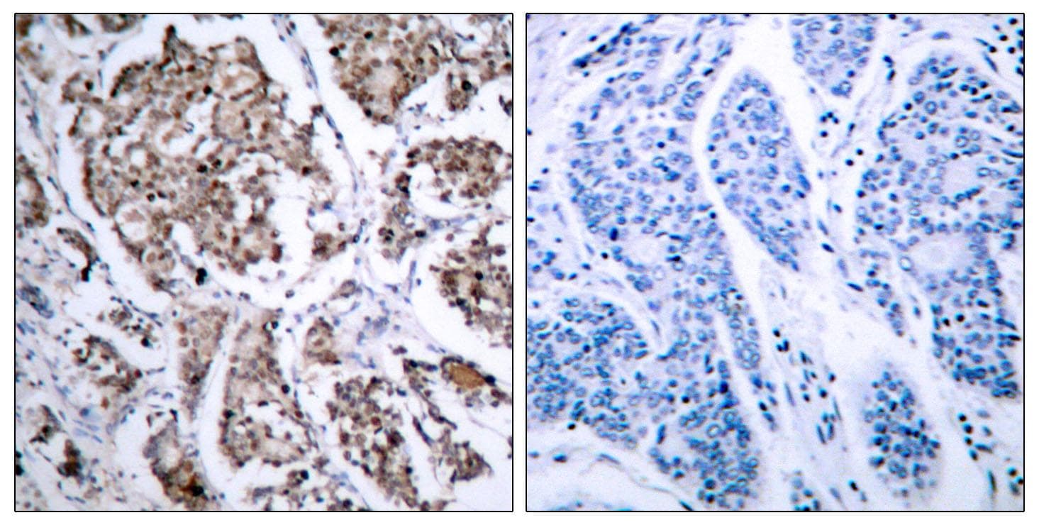 Polyclonal Rabbit anti-Human BAD Antibody (phospho-Ser155, IHC, WB)