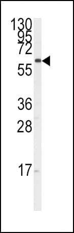 IHC-plus™ Polyclonal Rabbit anti-Human CYP17 / CYP17A1 Antibody (aa358-388, IHC, IF, WB)