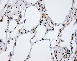 TLDC1 / KIAA1609 Antibody (clone OTI12B1)