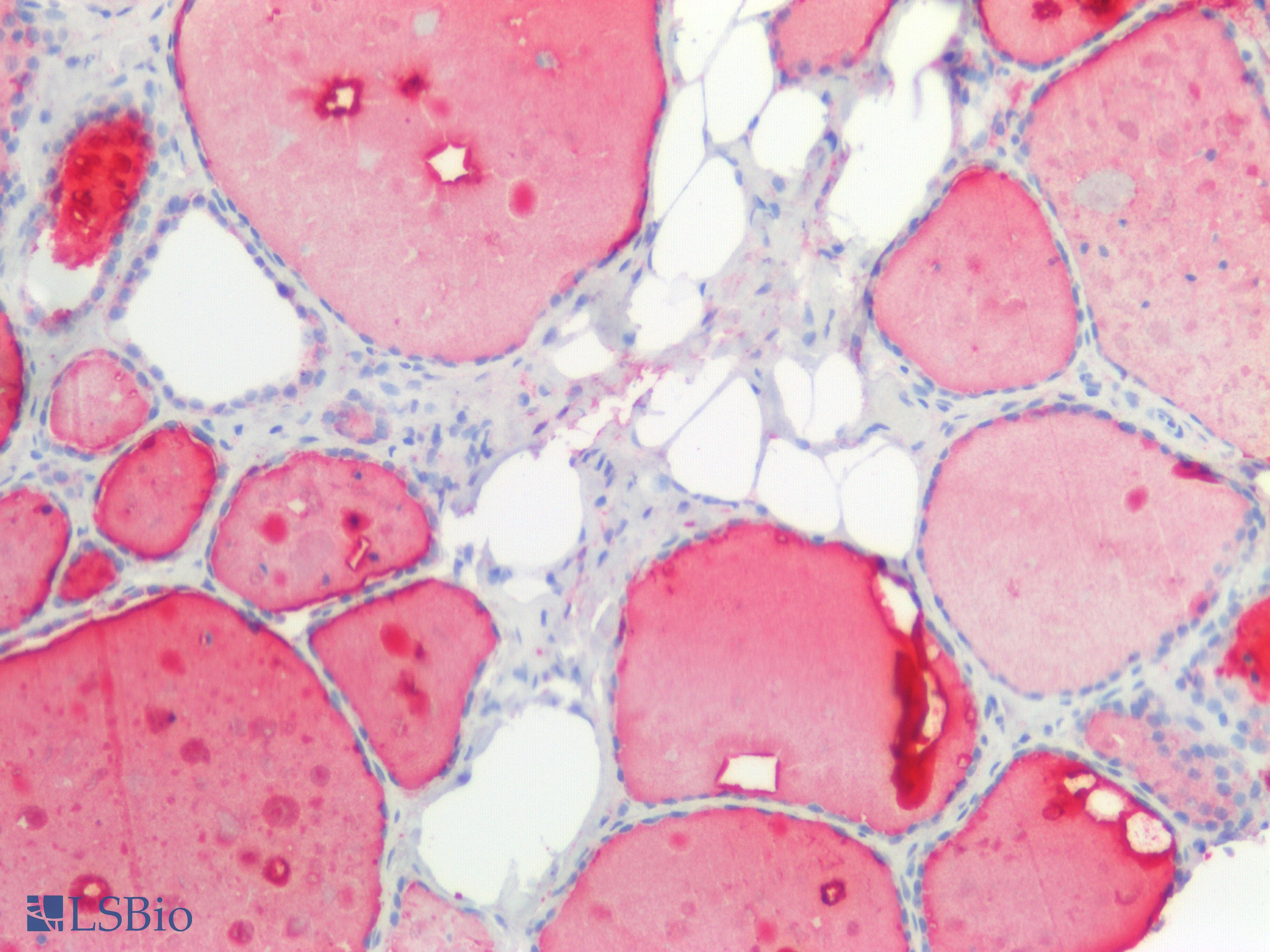 PathPlus™ rT3 / Reverse Triiodothyronine Antibody