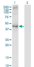 Monoclonal Mouse anti-Human TCN2 Antibody (clone 2F4, WB)