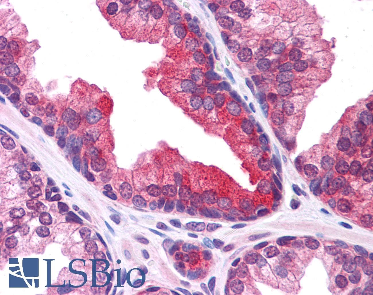 IHC-plus™ PLEKHM3 Antibody