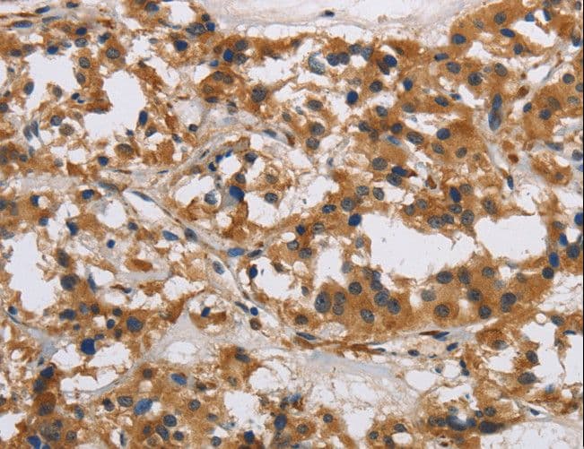 IHC-plus™ IL17RB Antibody