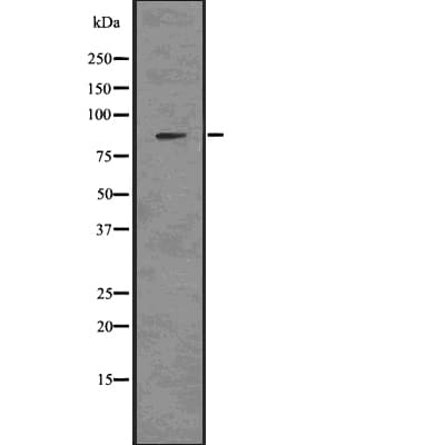 NPHS1 / Nephrin Antibody