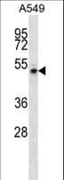NUDCD1 Antibody (aa194-223)