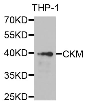 CKM / Creatine Kinase MM Antibody