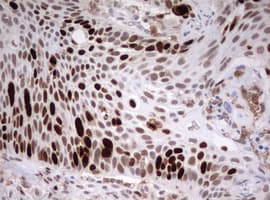 Monoclonal Mouse anti-Human TOP2A / Topoisomerase II Alpha Antibody (clone OTI2D12, aa1100-1531, IHC, WB)