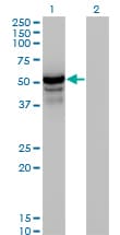 Monoclonal Mouse anti-Human HERPUD1 / HERP Antibody (clone 2G7, WB)