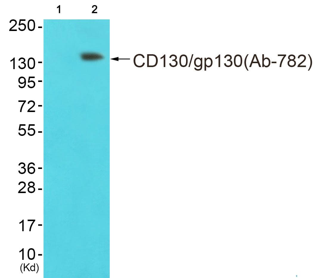 Polyclonal Rabbit anti-Human IL6ST / CD130 / gp130 Antibody (p782, IHC, IF, WB)