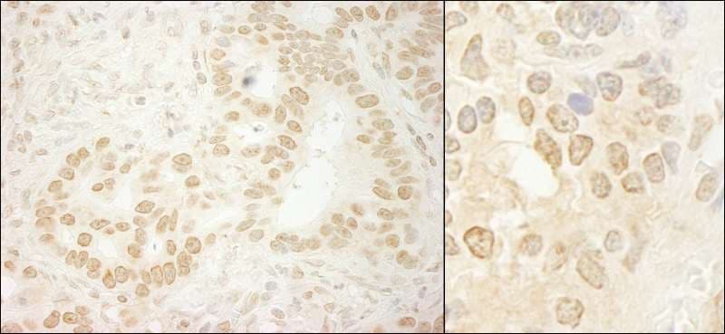 Polyclonal Rabbit anti-Human LEO1 Antibody (aa550-600, IHC, WB)