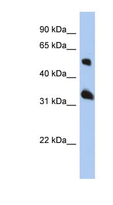 TSPAN33 / PEN Antibody (aa107-156)