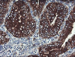 TPD52L3 Antibody (clone OTI8C12)