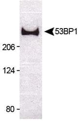 TP53BP1 / 53BP1 Antibody (Biotin)