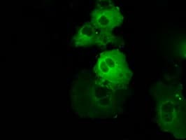 BTK Antibody (clone OTI3A2)