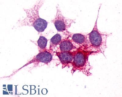 PathPlus™ P2RY14 / GPR105 Antibody (C-Terminus)