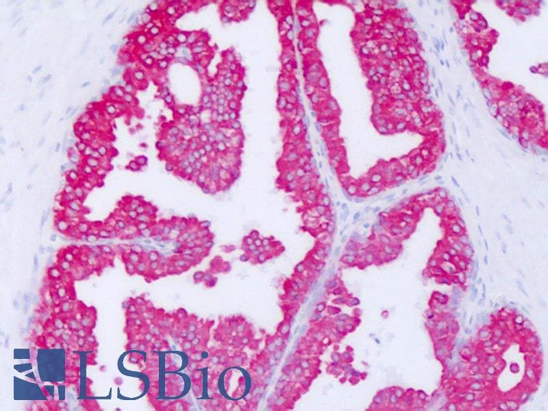 PathPlus™ KRT18 / CK18 / Cytokeratin 18 Antibody (clone DC-10, Concentrated)