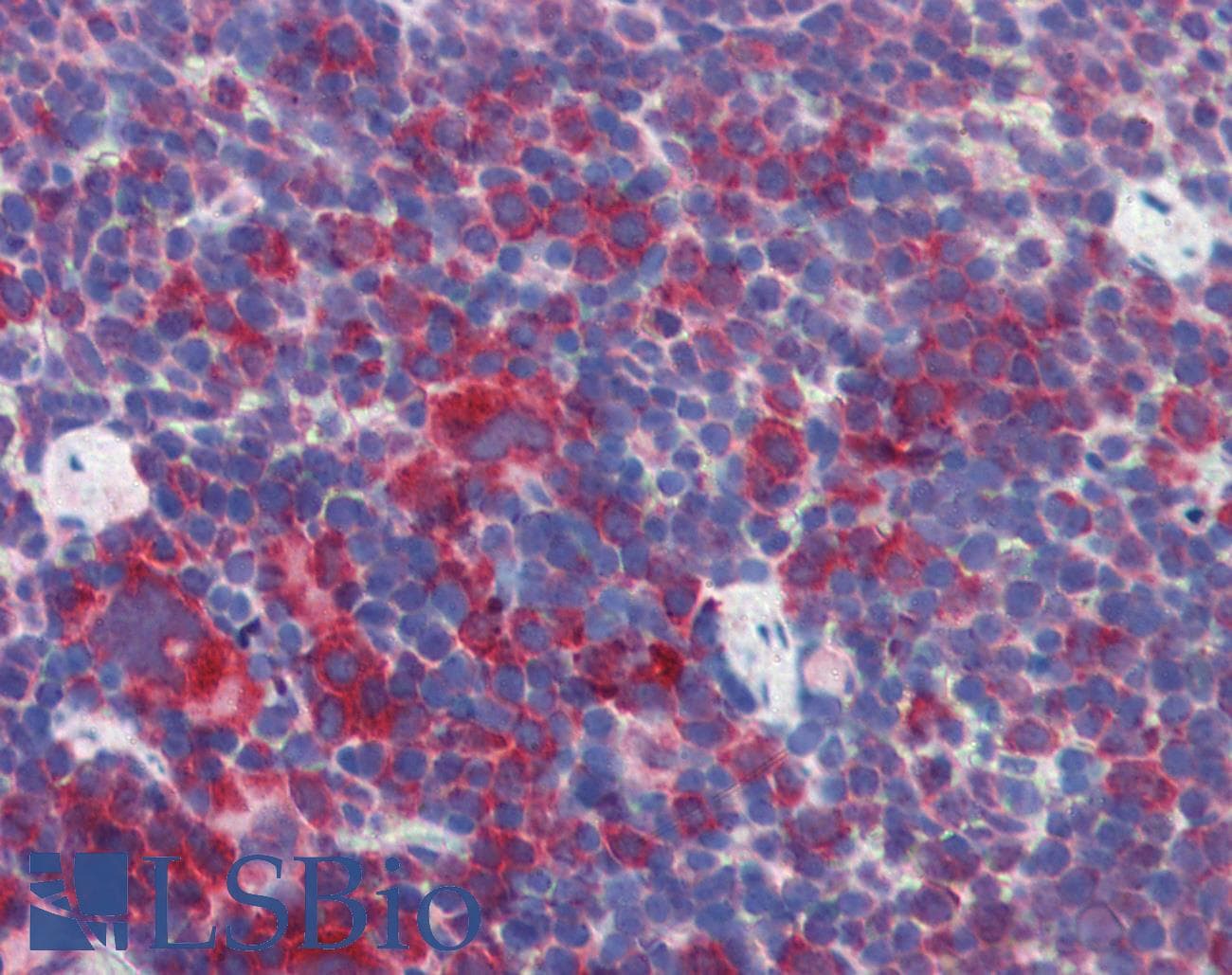IHC-plus™ Polyclonal Goat anti-Mouse PLIN3 / M6PRBP1 / TIP47 Antibody (aa309-322, IHC, WB)