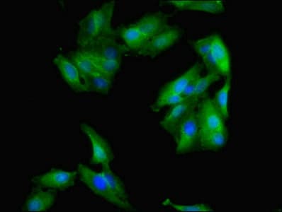 Polyclonal Rabbit anti-Human RPLP0 Antibody (aa1-317)