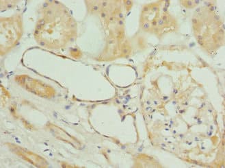 Polyclonal Rabbit anti-Human FXYD5 / Dysadherin Antibody (IHC)