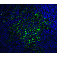 SQSTM1 Antibody