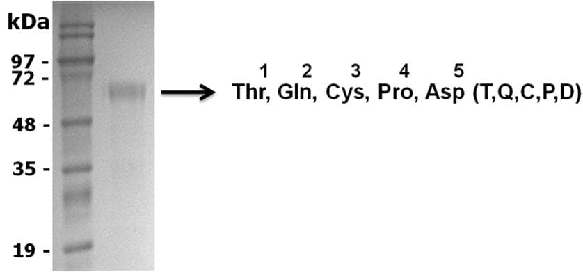 Rat GRN / Granulin Protein (Recombinant DDK (Flag))
