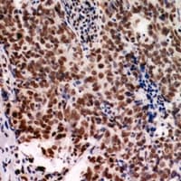 Polyclonal Rabbit anti-Human IOP1 / NARFL Antibody (IHC, WB)