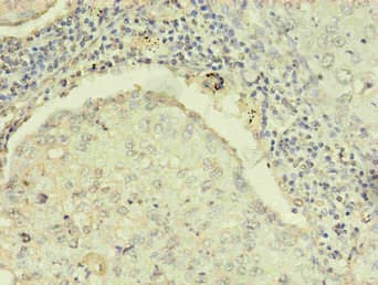 Monoclonal Mouse anti-Human R1 / RRM1 Antibody (clone 3D6H5, IHC)