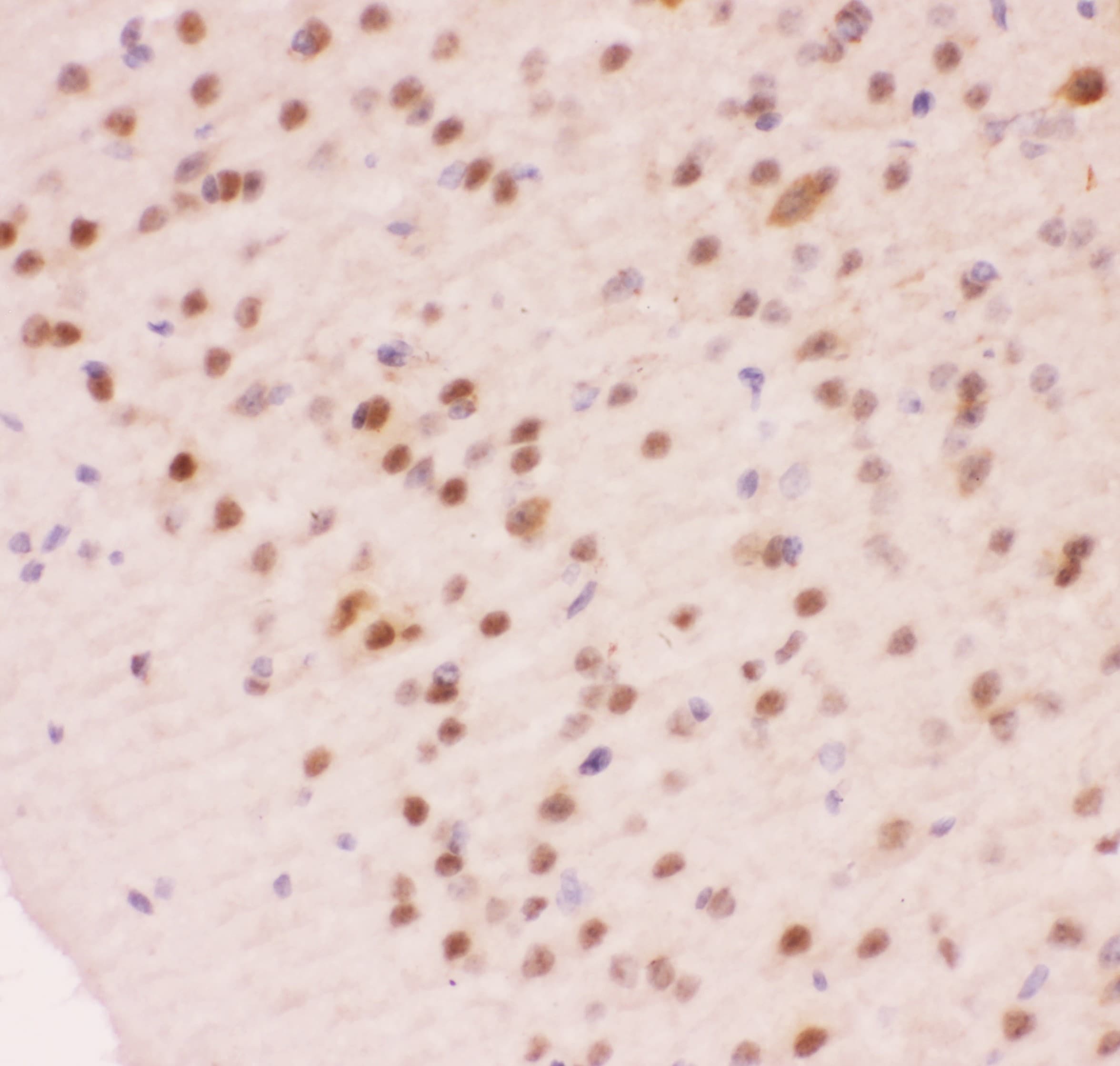 APEX1 / APE1 Antibody (aa2-318)