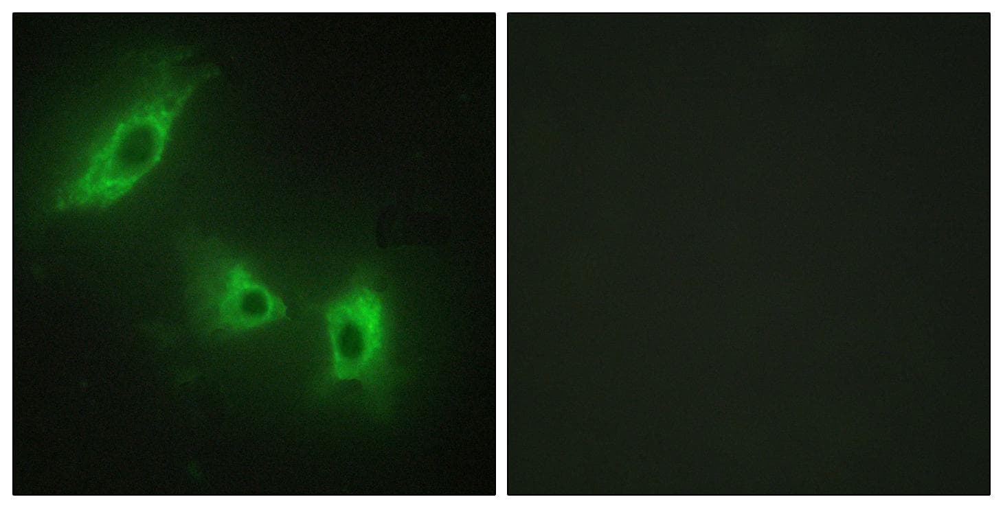 Polyclonal Rabbit anti-Human ACVR1B / ALK4 Antibody (IF, WB)