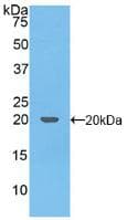 Human TNFSF10 / TRAIL Protein (Recombinant His, N-Terminal)