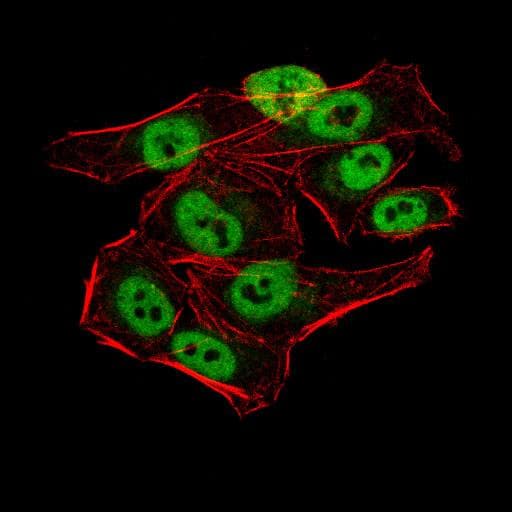 KDM1B Antibody (clone 5E10C1)