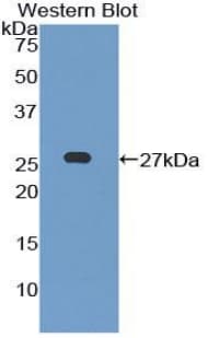 LILRB3 Antibody (aa410-631, Cy3)
