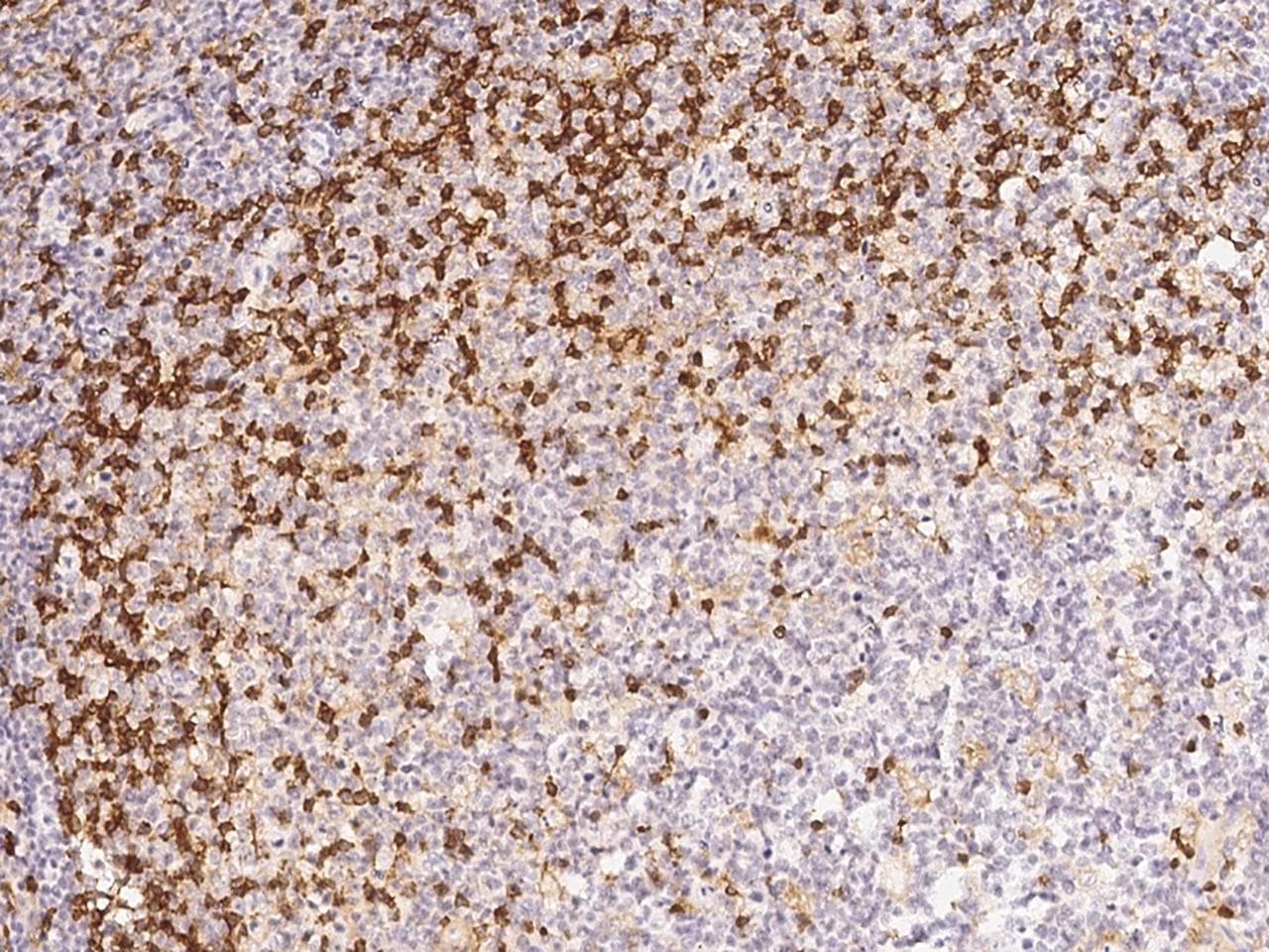 CD4 Antibody (clone 23, Preservative Free)