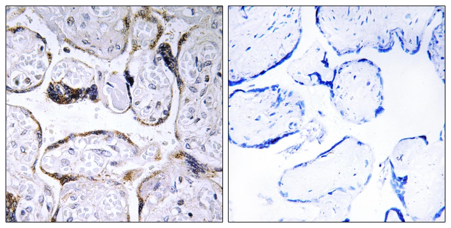 ELOVL3 Antibody